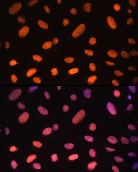 ZNF581 Antibody