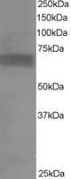 IHC-plus™ Polyclonal Goat anti-Human RPS6KB1 / P70S6K / S6K Antibody (aa490-502, IHC, WB)