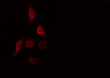 UBE2D2 / UBCH5B Antibody
