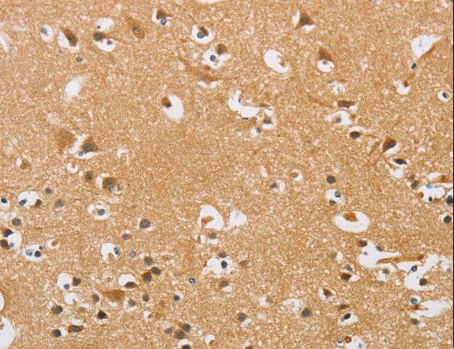 Polyclonal Rabbit anti-Human ARHGEF1 Antibody (IHC)