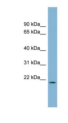 Polyclonal Rabbit anti-Human PACRGL Antibody (aa107-156, WB)