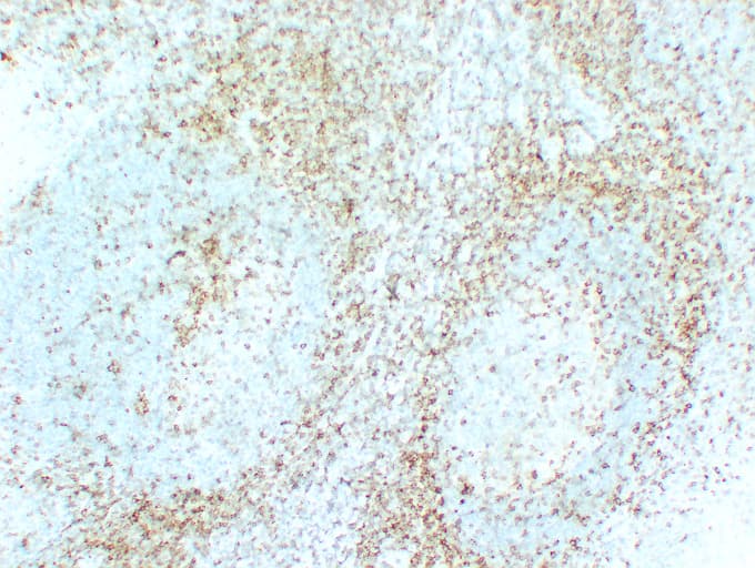 CD5 Antibody (clone ABT-CD5)