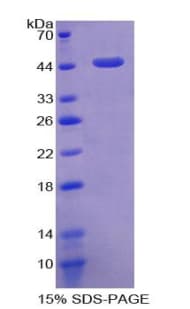 Mouse ACE2 / ACE-2 Protein (Recombinant His-T7)