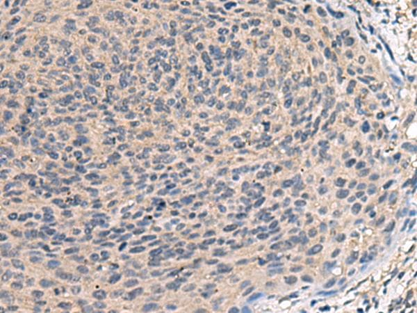 Polyclonal Rabbit anti-Human TNF Alpha Antibody (IHC)