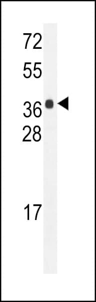 Polyclonal Rabbit anti-Human HARBI1 Antibody (aa4-33, IHC, WB)