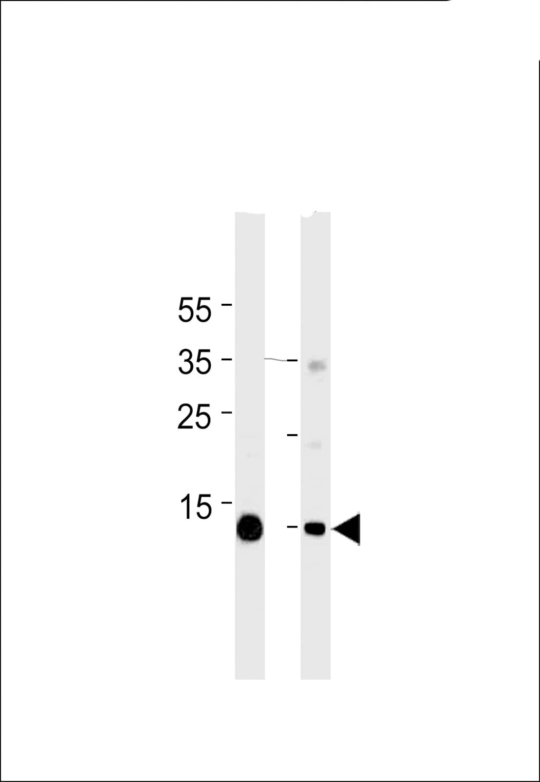 Monoclonal Mouse anti-Human MB / Myoglobin Antibody (aa103-130, WB)