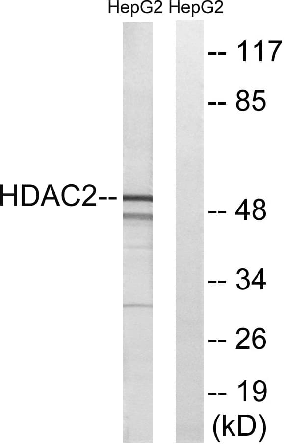 IHC-plus™ Polyclonal Rabbit anti-Human HDAC2 Antibody (aa360-409, IHC, WB)