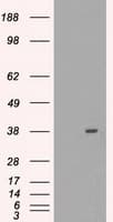 MRI1 Antibody (clone OTI6A10)