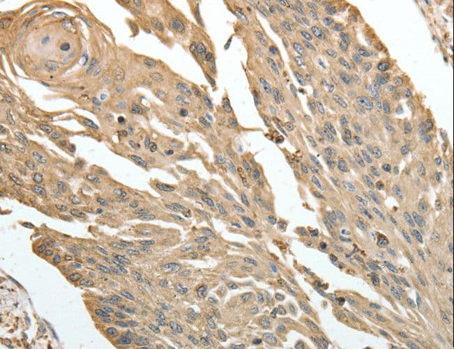 HSP90B1 / GP96 / GRP94 Antibody