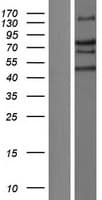 TRIM66 Protein (Over-Expression Lysate Myc-DDK (Flag))