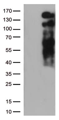 Monoclonal Mouse anti-Human LDLR / LDL Receptor Antibody (clone OTI7C5, Carrier-free, WB)