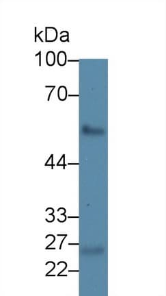 LAD1 Antibody (aa1-192, APC)