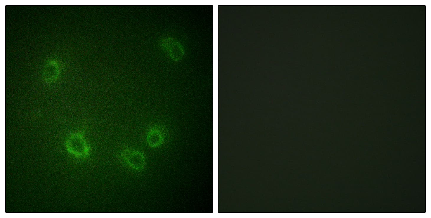 Polyclonal Rabbit anti-Human SCNN1B / ENaC Beta Antibody (phospho-Thr615, IHC, IF, WB)