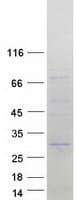 Human TNNI1 Protein (Recombinant Myc-DDK (Flag))