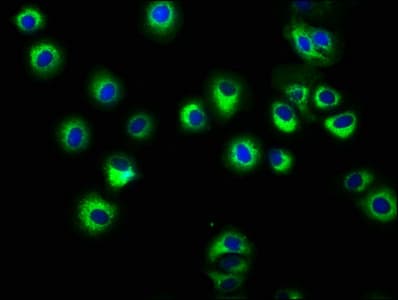 Polyclonal Rabbit anti-Human HLA Class I Histocompatibility Antigen, C-4 Alpha Chain Antibody (IHC, WB)