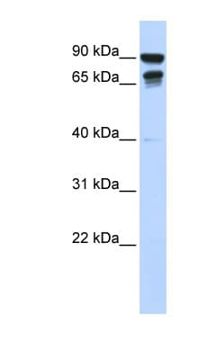 Polyclonal Rabbit anti-Human MSL3L1 / MSL3 Antibody (N-Terminus, WB)