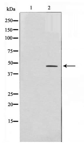 FABP4 / AP2 Antibody
