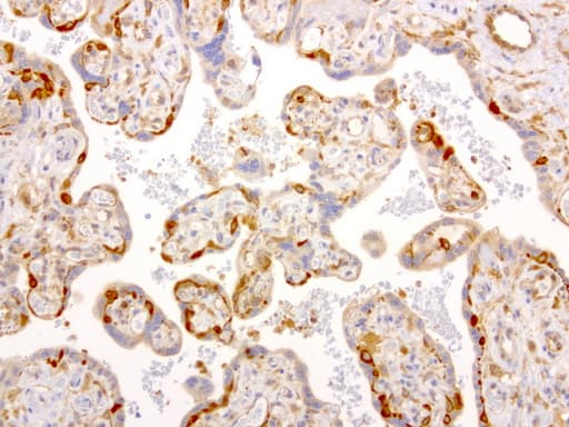 NME1 / NM23 Antibody (clone UMAB94)