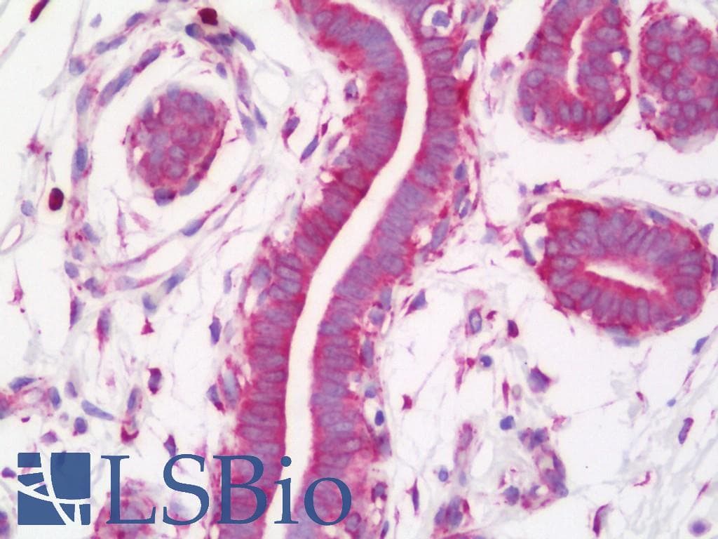 IHC-plus™ CKAP4 Antibody (aa500-550)
