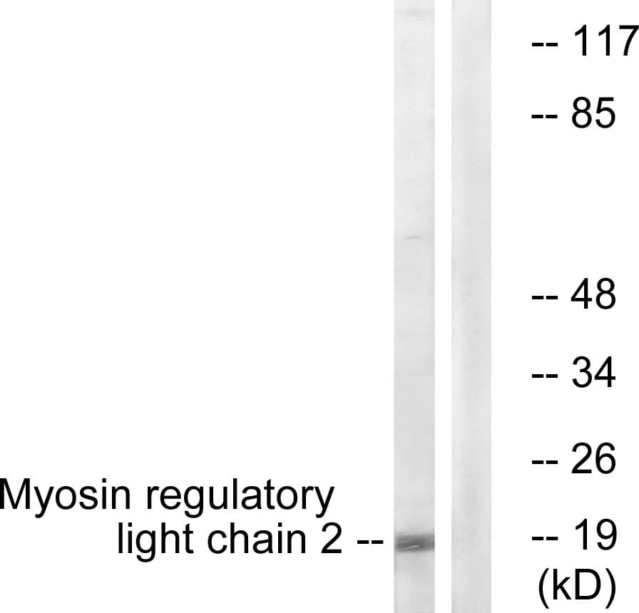 IHC-plus™ MLC2 / MYL9 Antibody (aa3-52)