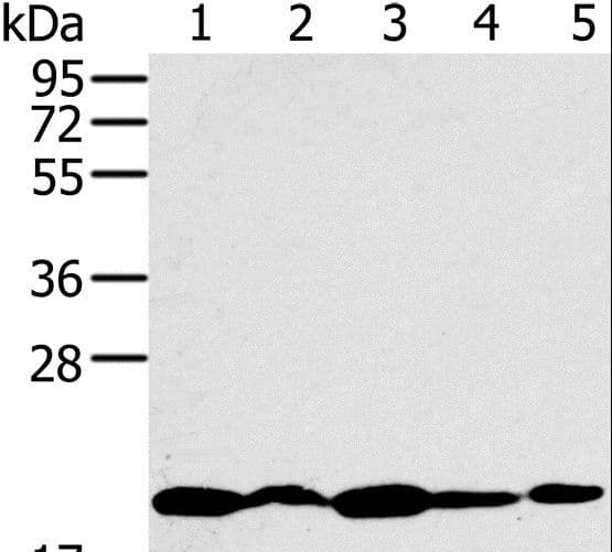 Polyclonal Rabbit anti-Human RMA1 / RNF5 Antibody (IHC, WB)