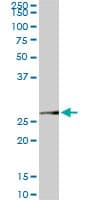 MTAP Antibody (clone 2G4)