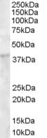 IHC-plus™ DKK1 Antibody (aa250-262)