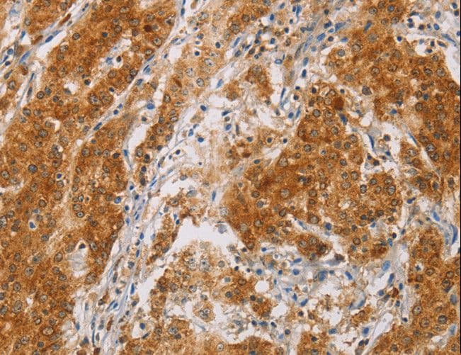 Polyclonal Rabbit anti-Human CENPE Antibody (IHC)