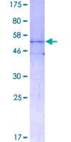 Human LFNG / Lunatic Fringe Protein (Recombinant GST)