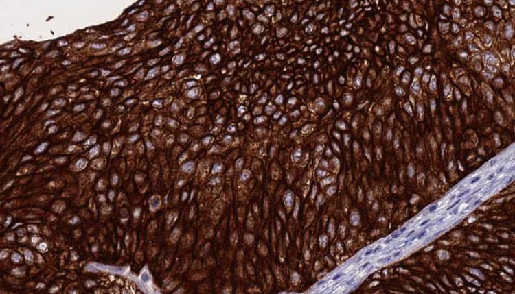 PRF1 / Perforin Antibody