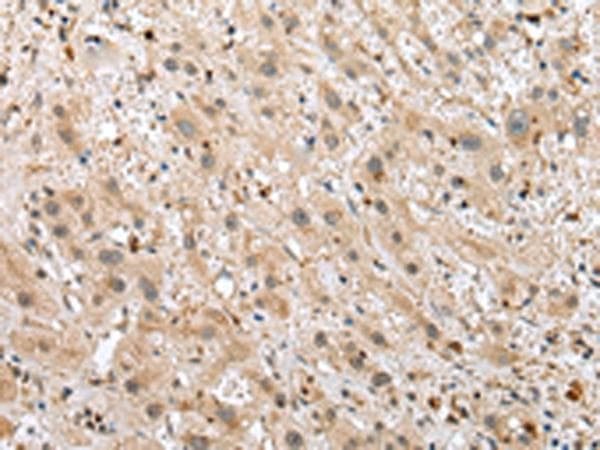 TPPP Antibody