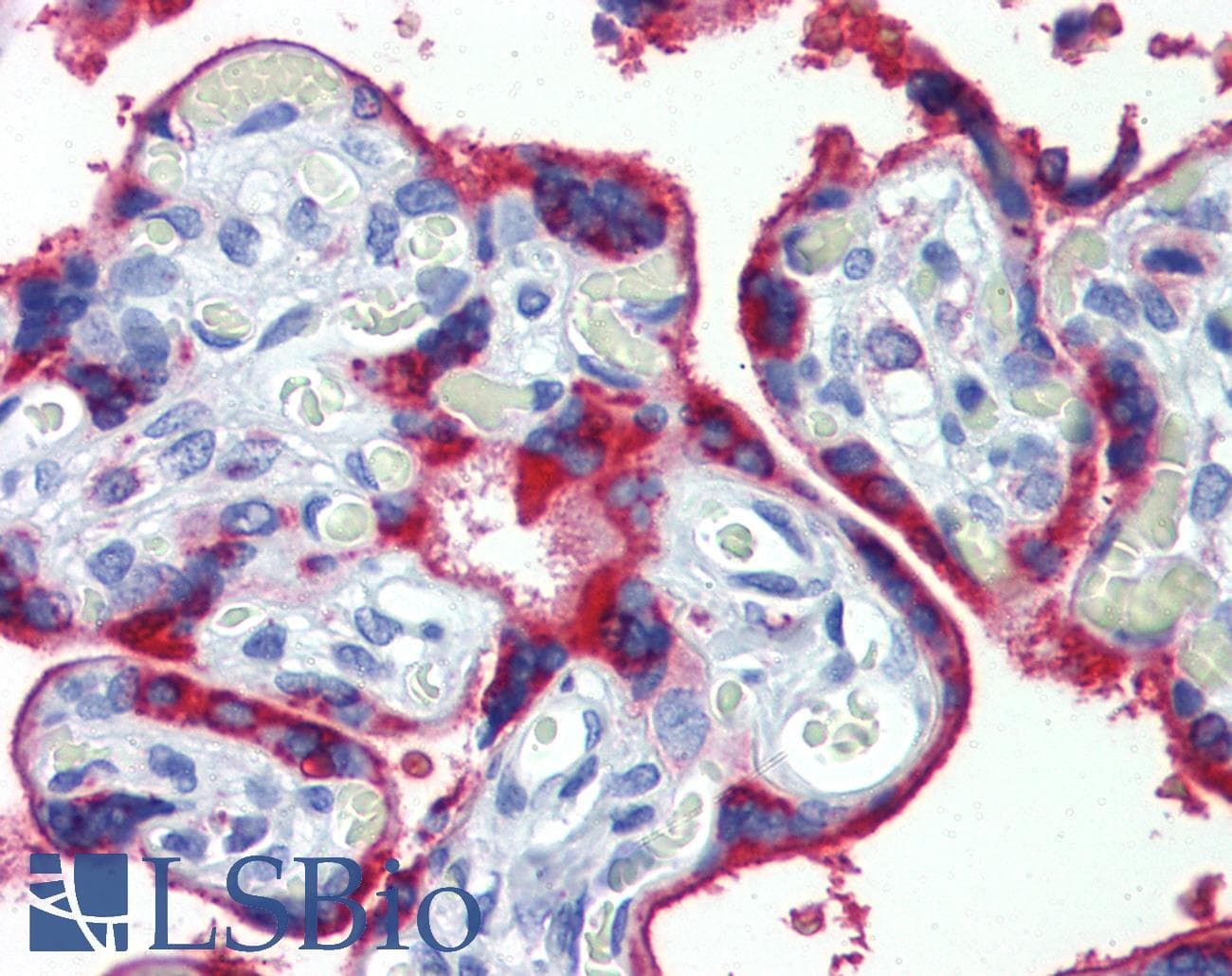IHC-plus™ Monoclonal Mouse anti-Human EPHB4 / EPH Receptor B4 Antibody (clone 5B5, Extracellular, IHC, IF, WB)