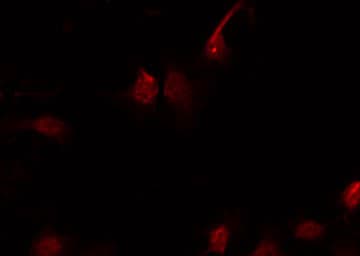 Polyclonal Rabbit anti-Human EIF4EBP1 / 4EBP1 Antibody (phospho-Thr45, IHC, IF, WB)