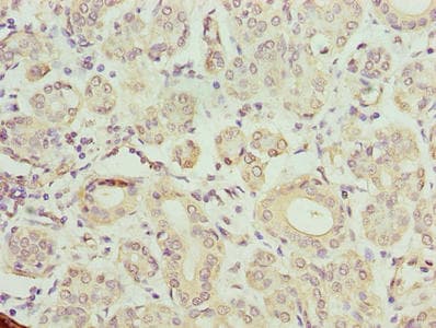 Polyclonal Rabbit anti-Human TMCC1 Antibody (IHC, WB)