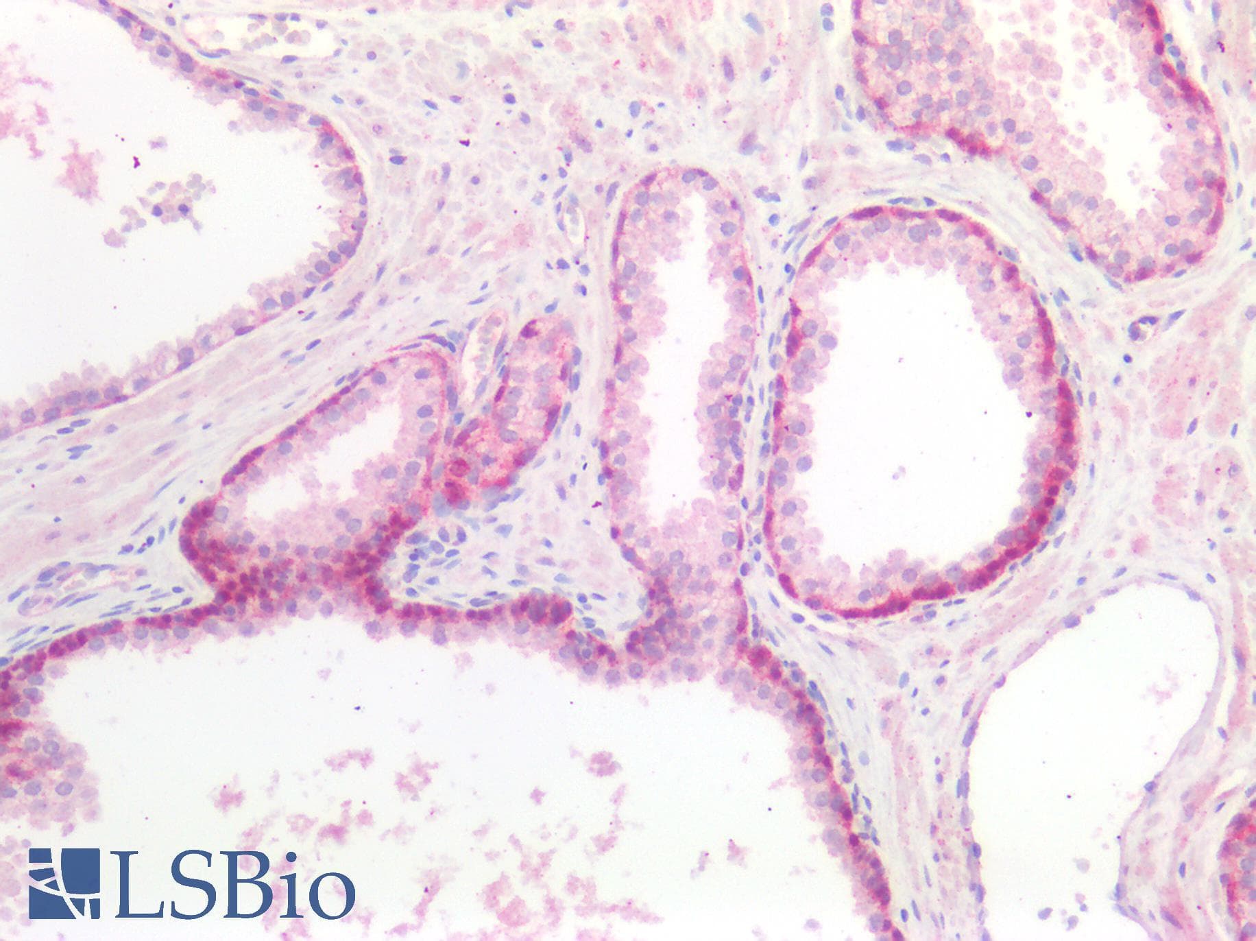 PathPlus™ Polyclonal Rabbit anti-Human GDF15 Antibody (IHC)