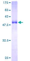 Human EPDR / EPDR1 Protein (Recombinant GST)