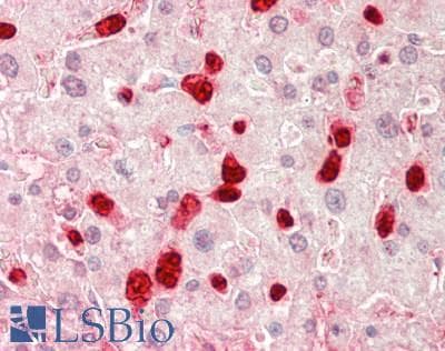 TOM1L1 Antibody (aa276-325)