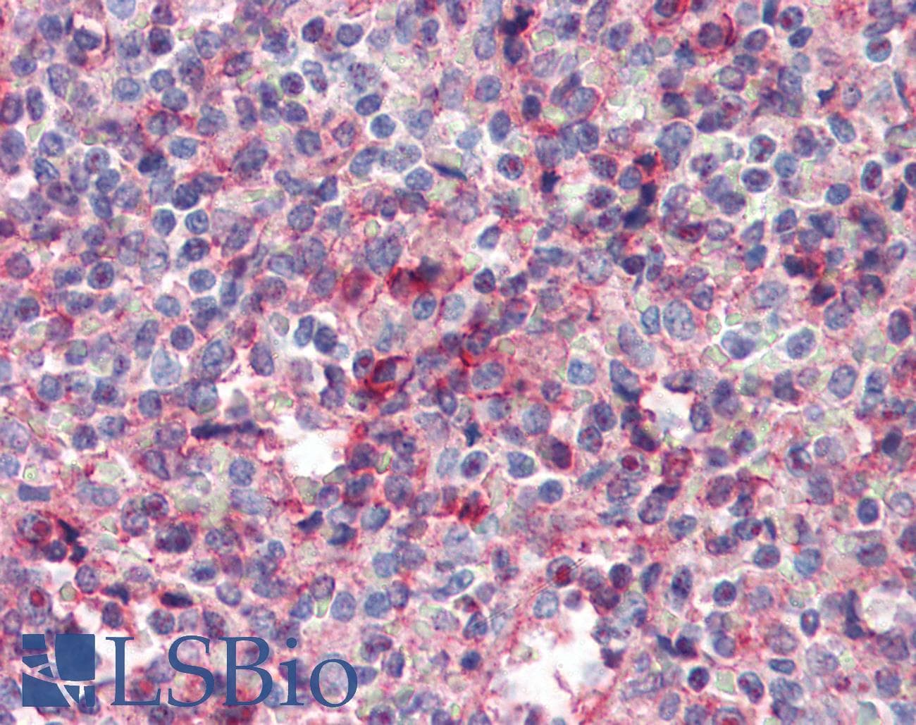 IHC-plus™ Monoclonal Mouse anti-Human PECAM-1 / CD31 Antibody (clone 2F7B2, IHC, IF, WB)