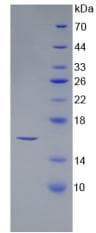 Human SFRP5 Protein (Recombinant His)