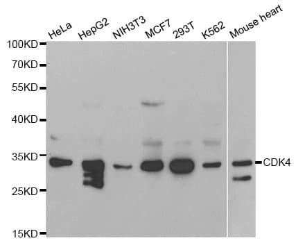 Polyclonal Rabbit anti-Human CDK4 Antibody (IHC, IF, WB)