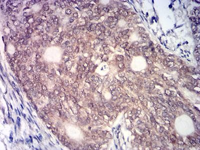 Monoclonal Mouse anti-Human MYST2 / HBO1 Antibody (clone 1D9H9, IHC, WB)