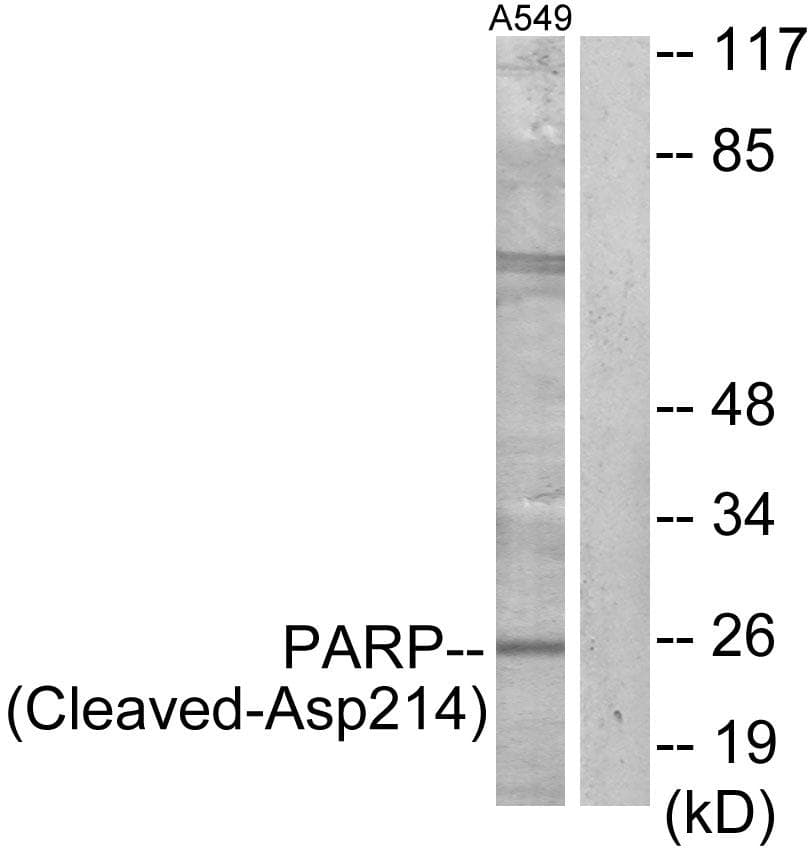 PARP1 Antibody (Cleaved-Asp214)