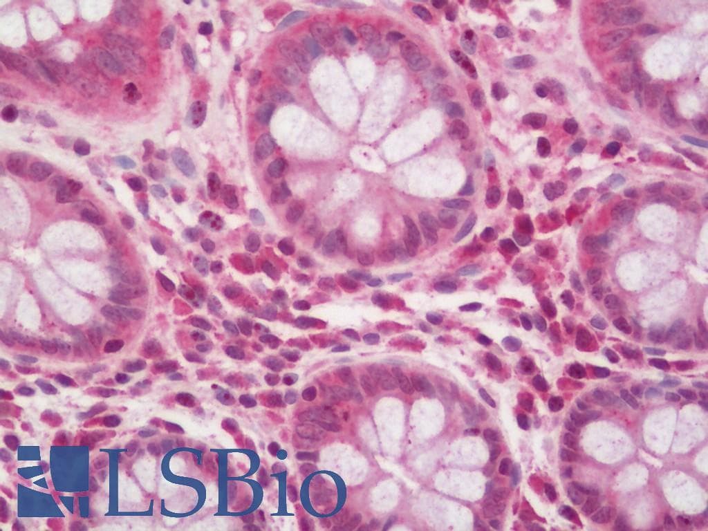 NPHP1 / Nephronophthisis Antibody (Biotin)