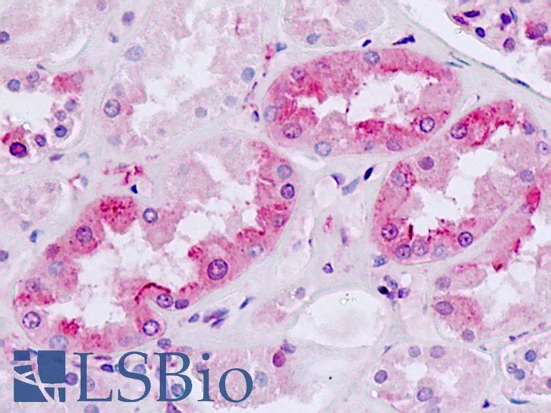 IHC-plus™ MC4R / Melanocortin 4 Receptor Antibody (Cytoplasmic Domain)