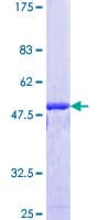 Human IDN3 / NIPBL Protein (Recombinant GST)