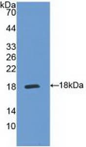 IL5RA / CD125 Antibody (aa42-182)