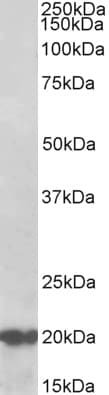 IHC-plus™ DNAJC5 / CSP Antibody (aa177-191)