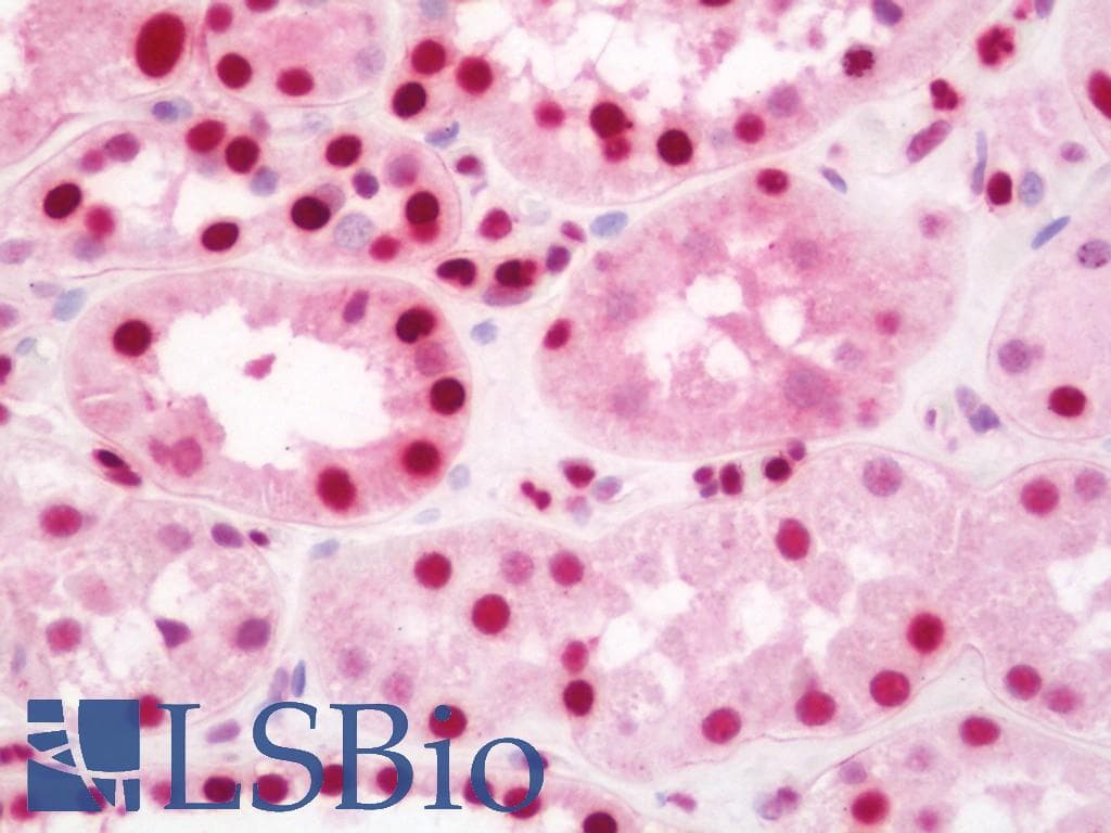 IHC-plus™ Monoclonal Mouse anti-Human AATF Antibody (clone 3C7, IHC, IF, WB)