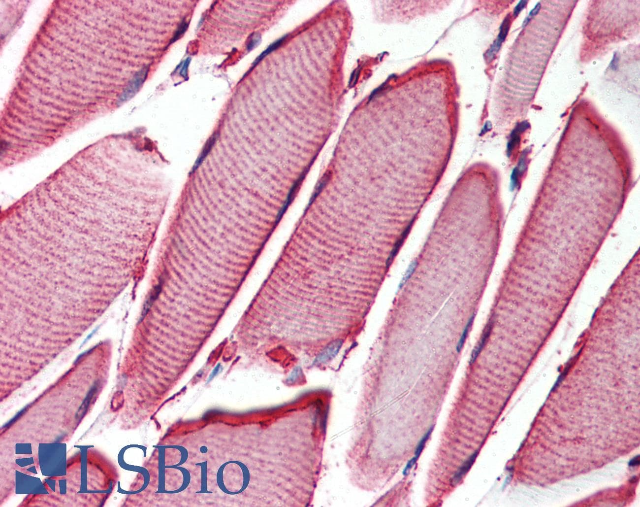 IHC-plus™ Polyclonal Rabbit anti-Human HSPB6 / HSP20 Antibody (IHC, WB)