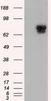 Monoclonal Mouse anti-Human PDE4A / PDE4 Antibody (clone OTI1E3, IF, WB)